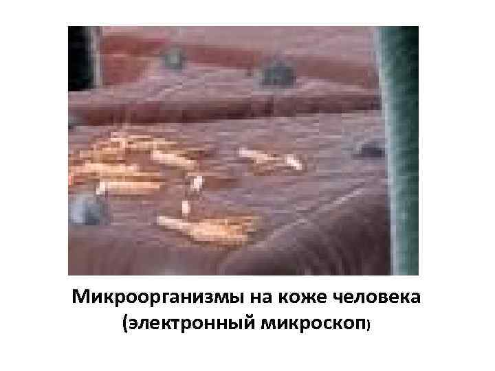 Микроорганизмы на коже человека (электронный микроскоп) 