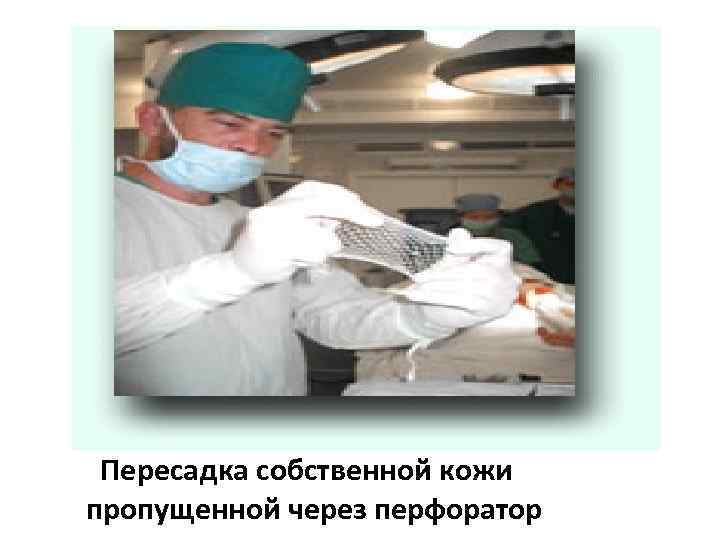 Пересадка собственной кожи пропущенной через перфоратор 