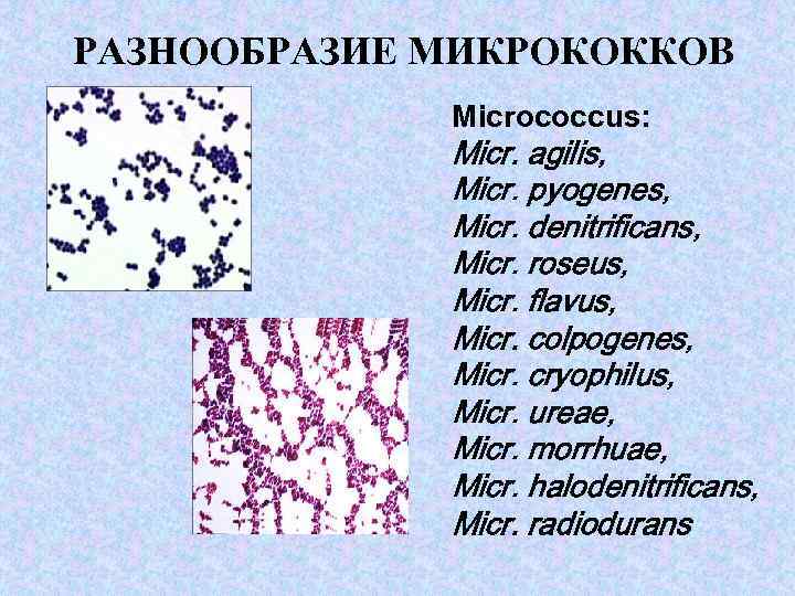 РАЗНООБРАЗИЕ МИКРОКОККОВ Micrococcus: Micr. agilis, Micr. pyogenеs, Micr. denitrificans, Micr. roseus, Micr. flavus, Micr.