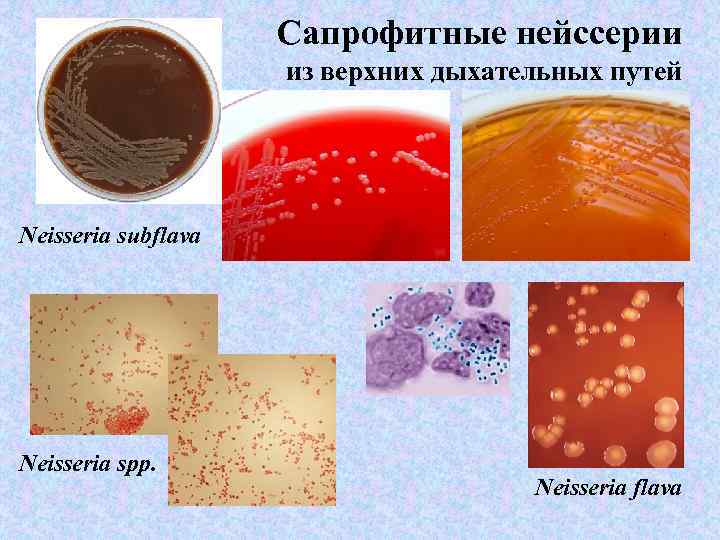  Сапрофитные нейссерии из верхних дыхательных путей Neisseria subflava Neisseria sрр. Neisseria flava 