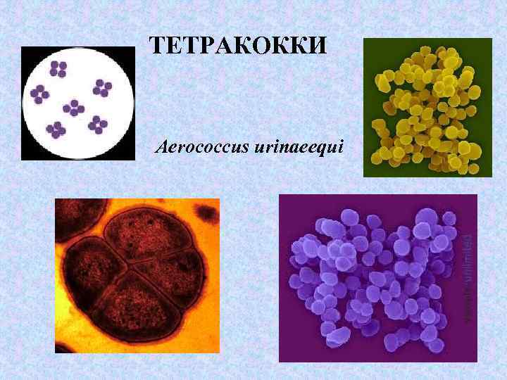  ТЕТРАКОККИ Aerococcus urinaeequi 