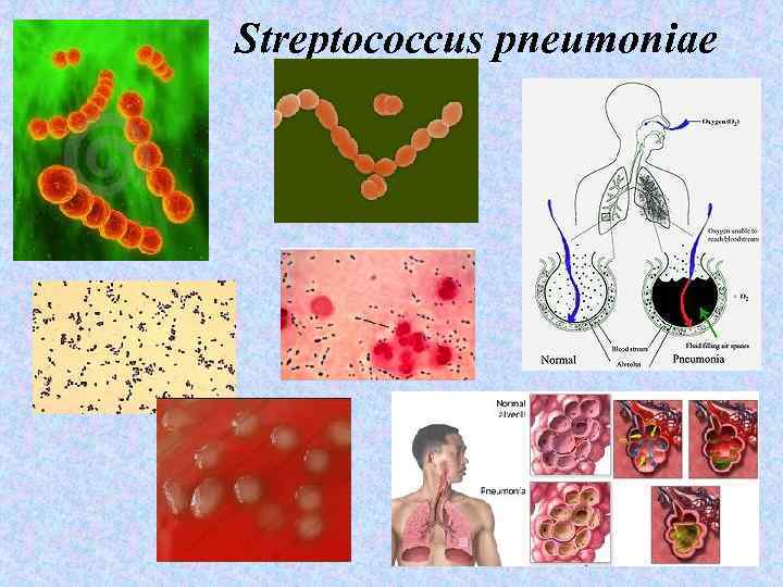 Streptococcus рneumoniae 