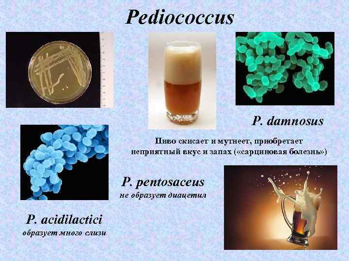 Pediococcus P. damnosus Пиво скисает и мутнеет, приобретает неприятный вкус и запах ( «сарциновая