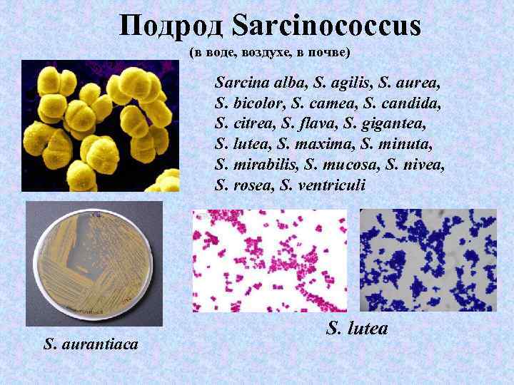 Подрод Sarcinococcus (в воде, воздухе, в почве) Sarcina alba, S. agilis, S. aurea, S.