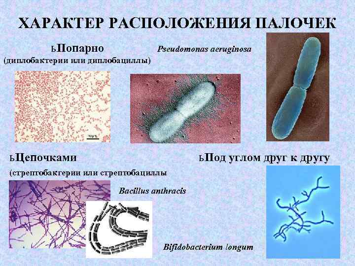 Представители группы бактерии. Палочковидные формы бактерий. Морфология микроорганизмов. Палочковидные одноклеточные бактерии. Палочковидные морфология.