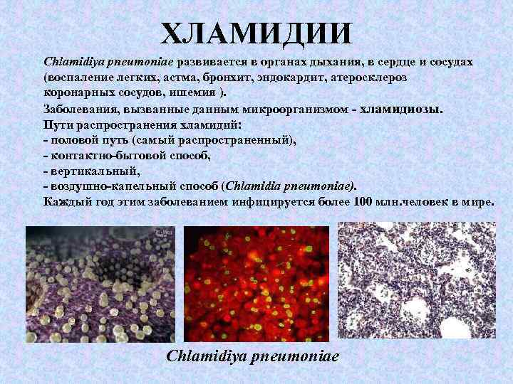 Виды хламидий. Хламидии морфология микробиология. Chlamydia pneumoniae морфология. Хламидии по типу дыхания. Тип дыхания хламидий.