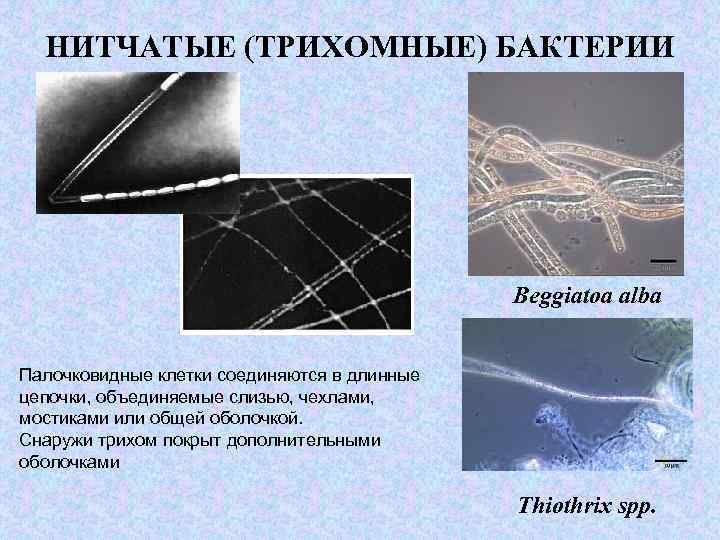 Нитевидные бактерии. Нитчатые бактерии. Нитчатые серобактерии. Нитчатые формы бактерий. Нитевидные микроорганизмы.