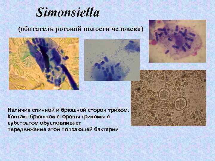 Simonsiella (обитатель ротовой полости человека) Наличие спинной и брюшной сторон трихом. Контакт брюшной стороны