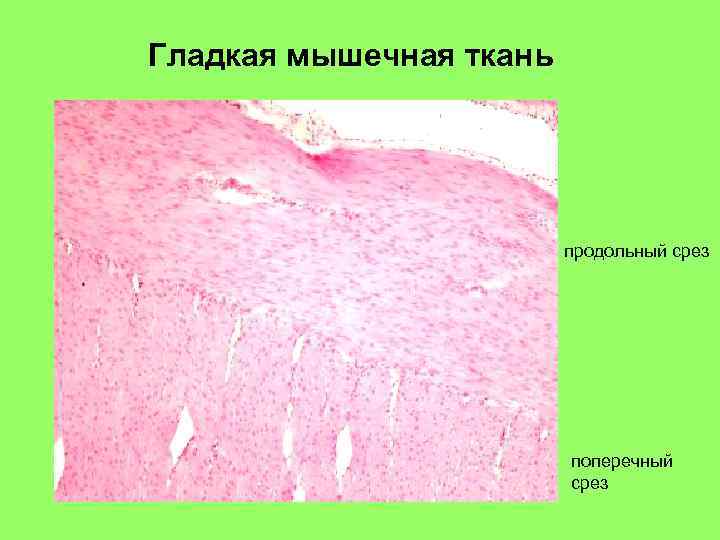 Гладкая мышечная ткань продольный срез поперечный срез 