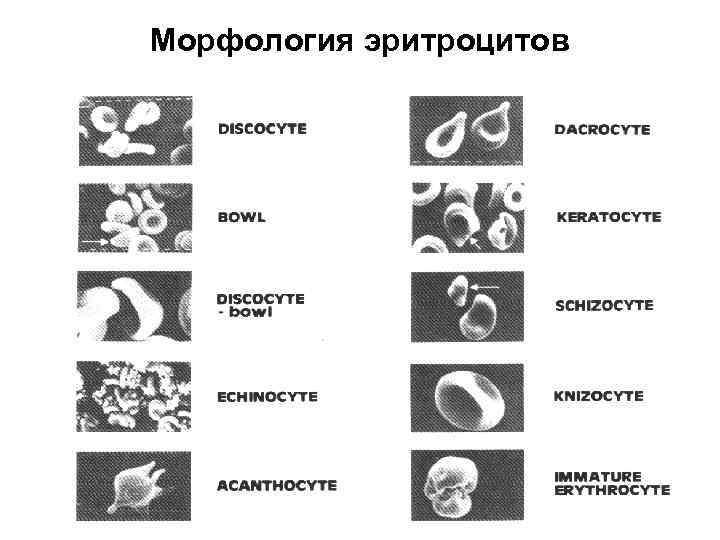 Морфология эритроцитов 