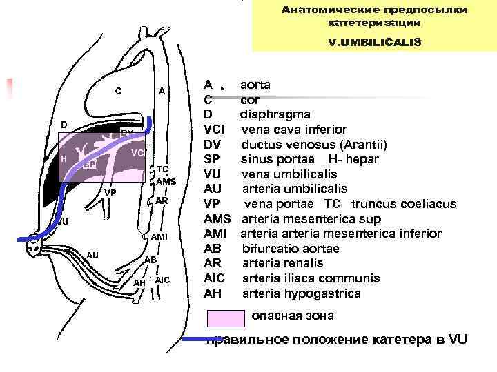 Анатомические предпосылки катетеризации V. UMBILICALIS A aorta C cor D diaphragma VCI vena cava