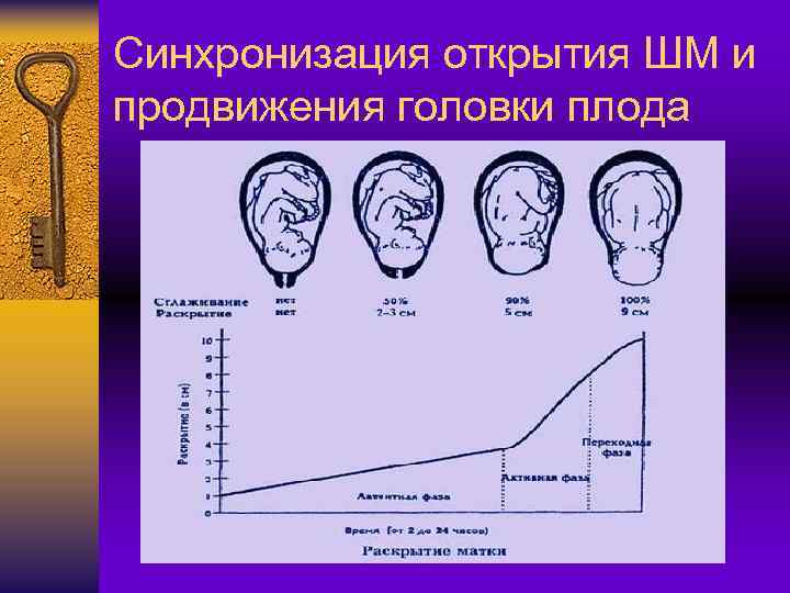 Синхронизация открытия ШМ и продвижения головки плода 