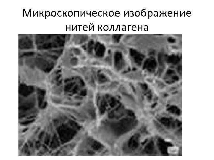 Микроскопическое изображение нитей коллагена 