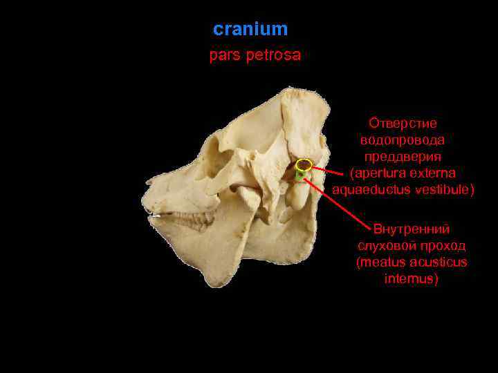 cranium pars petrosa Отверстие водопровода преддверия (apertura externa aquaeductus vestibule) Внутренний слуховой проход (meatus