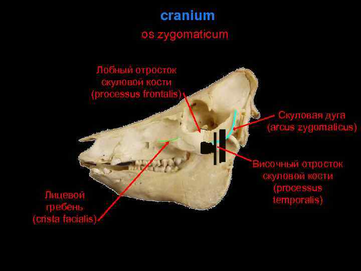 cranium os zygomaticum Лобный отросток скуловой кости (processus frontalis) Скуловая дуга (arcus zygomaticus) Лицевой