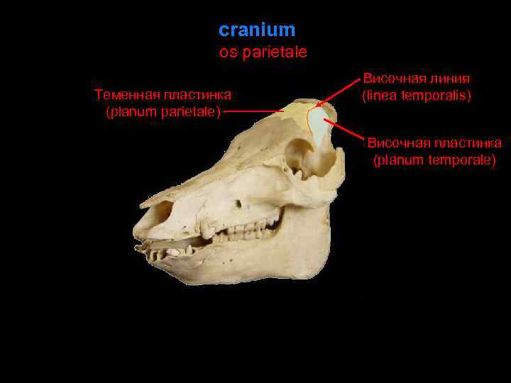 cranium os parietale Теменная пластинка (planum parietale) Височная линия (linea temporalis) Височная пластинка (planum