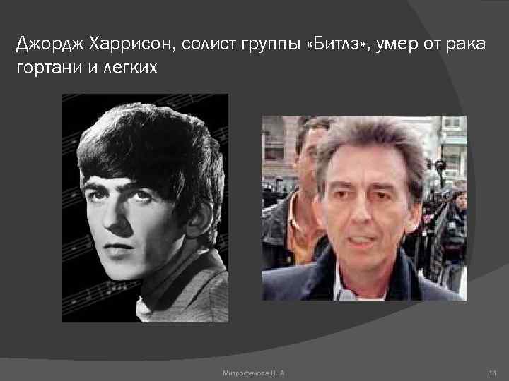 Джордж Харрисон, солист группы «Битлз» , умер от рака гортани и легких Митрофанова Н.