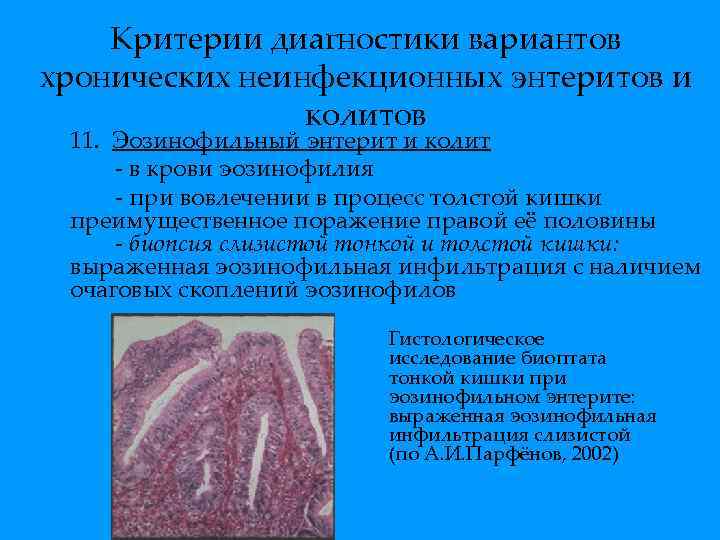 Критерии диагностики вариантов хронических неинфекционных энтеритов и колитов 11. Эозинофильный энтерит и колит -