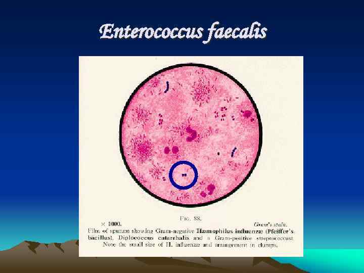 Enterococcus faecalis 