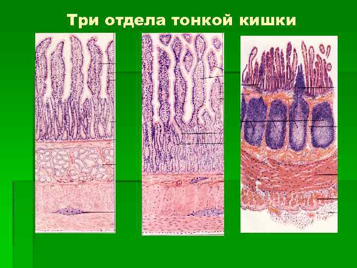 Три отдела тонкой кишки 