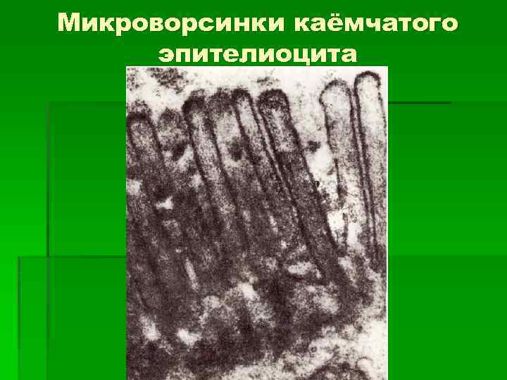 Микроворсинки каёмчатого эпителиоцита 