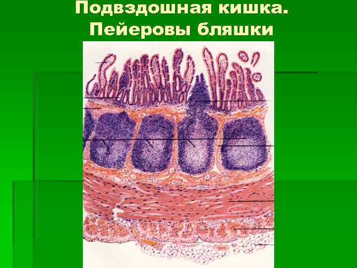 Схема строения пейеровой бляшки