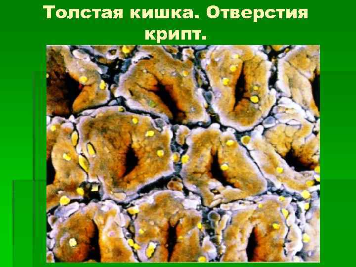 Толстая кишка. Отверстия крипт. 