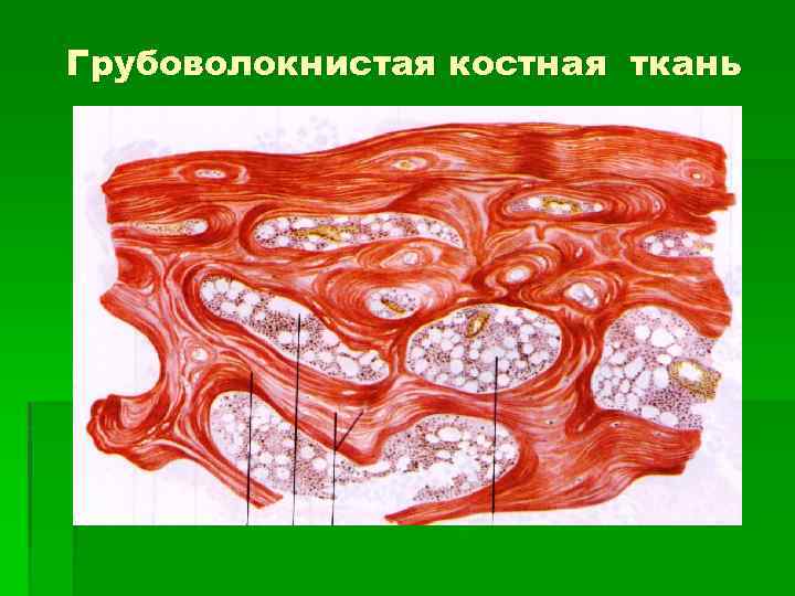 Соединительная ткань костей