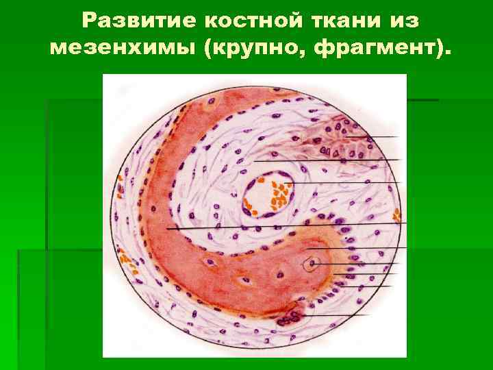Развитие костной ткани из мезенхимы (крупно, фрагмент). 