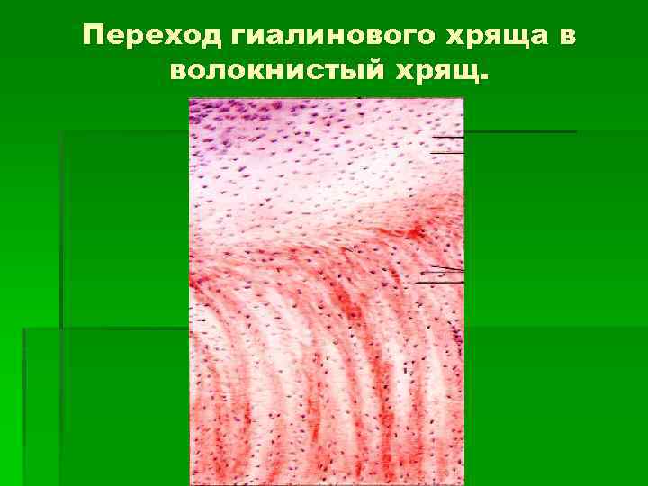Переход гиалинового хряща в волокнистый хрящ. 