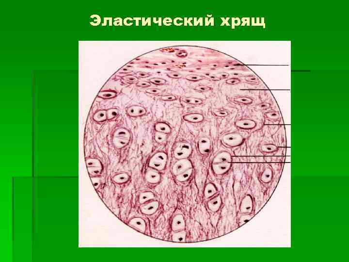 Эластический хрящ 