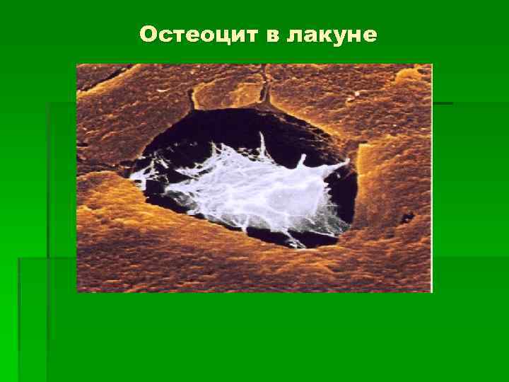 Остеоцит в лакуне 