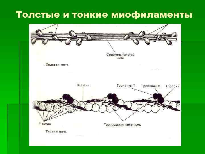 Толстые и тонкие миофиламенты 