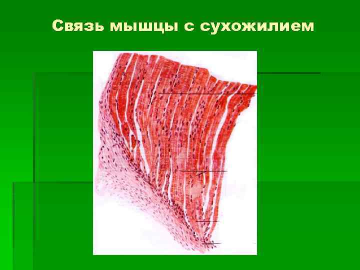 Связь мышц. Связь мышцы с сухожилием. Связь мышцы с сухожилием ткань. Связь мышцы с сухожилием гистология.