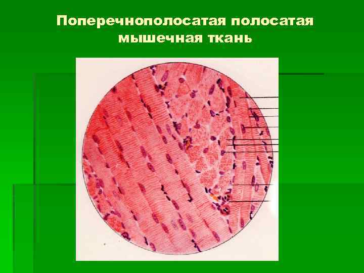 Поперечнополосатая ткань