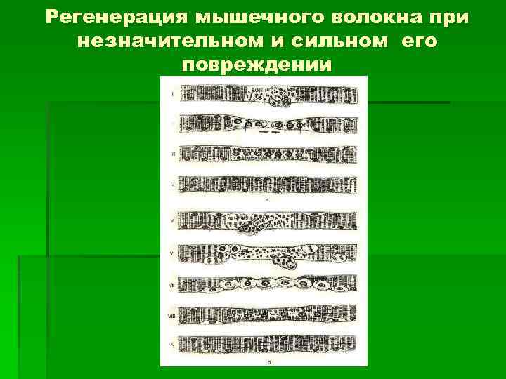 Регенерация мышечного волокна при незначительном и сильном его повреждении 