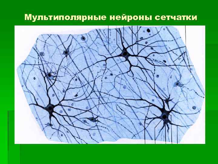 Мультиполярные нейроны сетчатки 