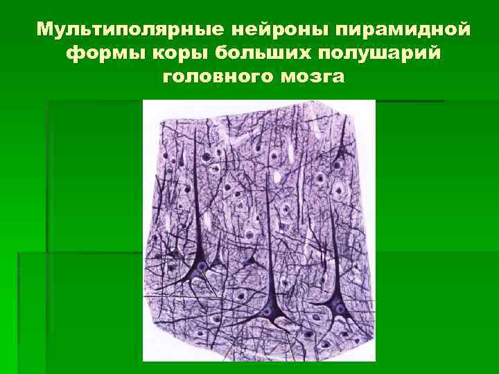 Мультиполярные нейроны пирамидной формы коры больших полушарий головного мозга 