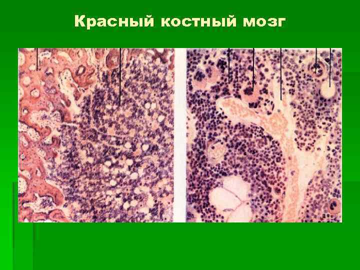 Красный костный мозг структура. Строение красного костного мозга гистология. Красный костный мозг гистология. Красный костный мозг гистология препарат. Срез красного костного мозга гистология.