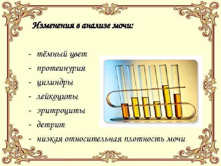 Изменения в анализе мочи: - тёмный цвет протеинурия цилиндры лейкоциты эритроциты детрит низкая относительная