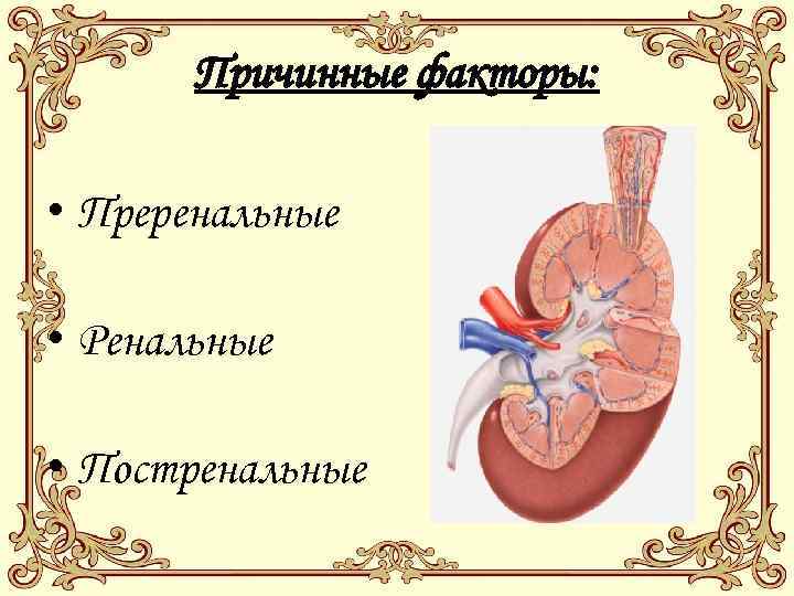 Причинные факторы: • Преренальные • Ренальные • Постренальные 