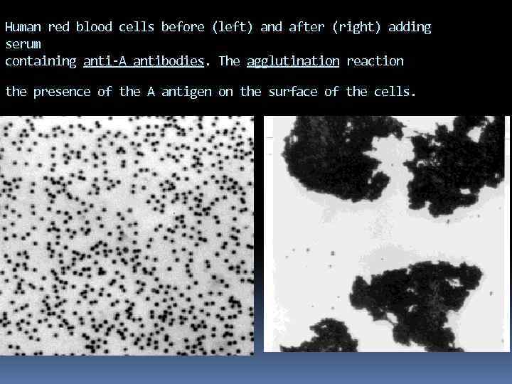 Human red blood cells before (left) and after (right) adding serum containing anti-A antibodies.