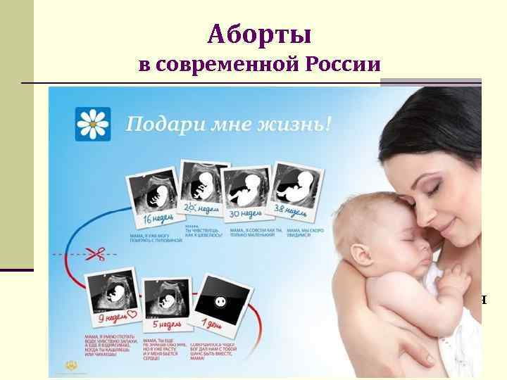 Аборты в современной России § § 2011 г. – ФЗ «Об основах охраны здоровья