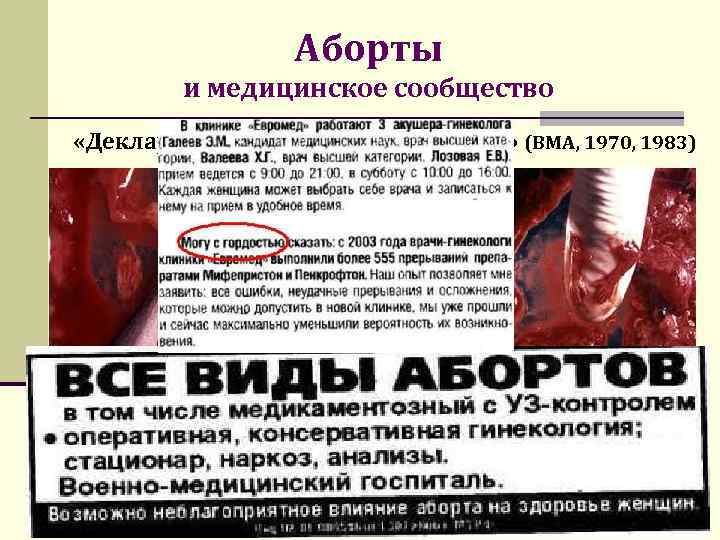 Аборты и медицинское сообщество «Декларация о медицинских абортах» (ВМА, 1970, 1983) Медицинское сообщество признает,