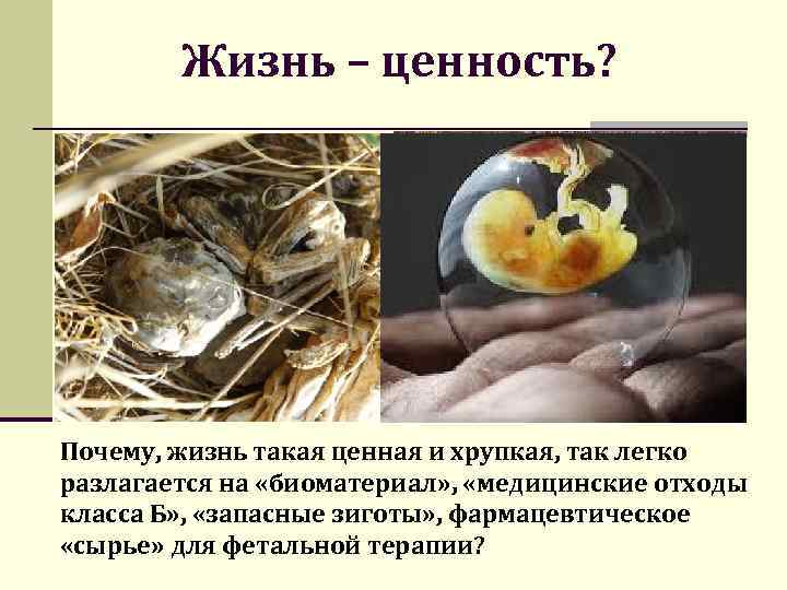 Жизнь – ценность? Почему, жизнь такая ценная и хрупкая, так легко разлагается на «биоматериал»
