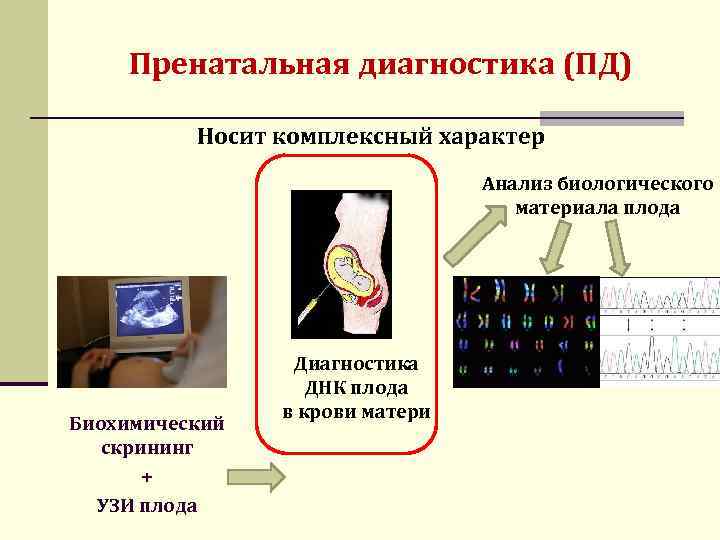 Пренатальная диагностика (ПД) Носит комплексный характер Анализ биологического материала плода Биохимический скрининг + УЗИ