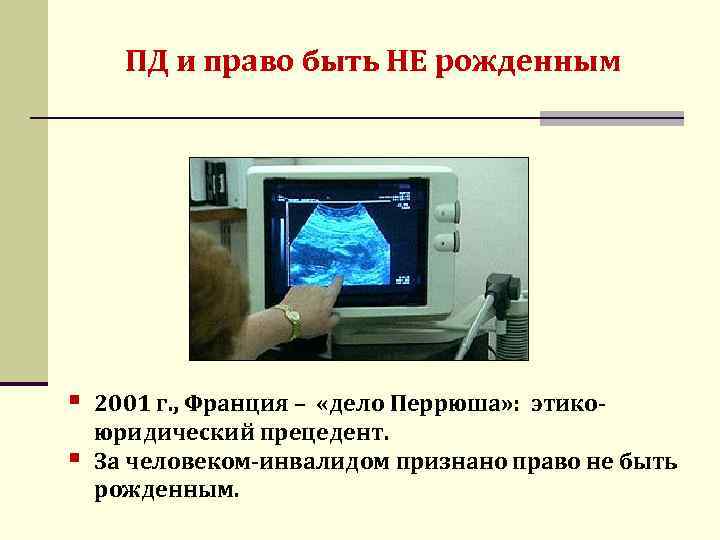 ПД и право быть НЕ рожденным § § 2001 г. , Франция – «дело