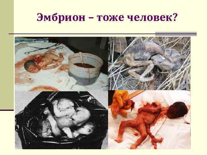 Эмбрион – тоже человек? Предложенная редакция части 2 статьи 17 главы 2 Конституции РФ