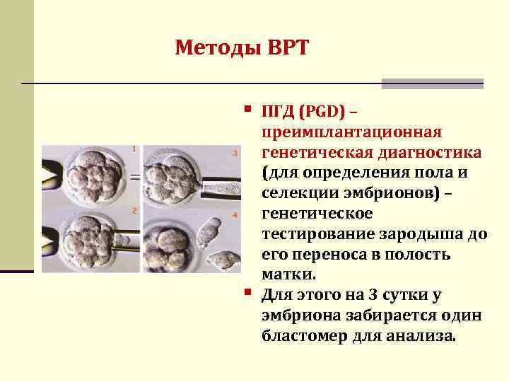 Методы ВРТ § § ПГД (PGD) – преимплантационная генетическая диагностика (для определения пола и