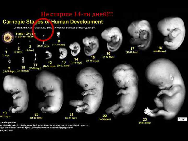 Не старше 14 -ти дней!!! 